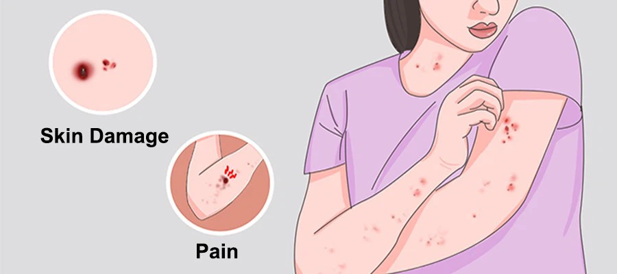 Skin infection1 Skin infection1